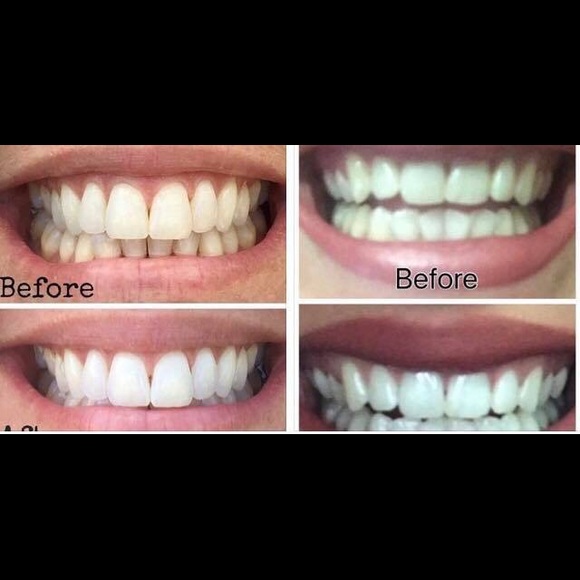 Whitening toothpaste - Picture 7 of 8